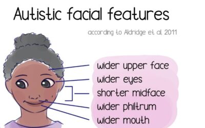 Facial Features of Autism