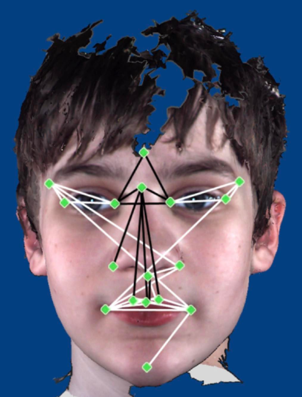 facial-features-of-autism-autism-family-circus